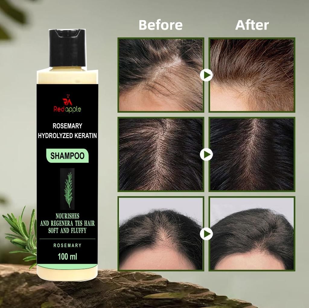 Rosemary & Hydrolyzed Keratin Shampoo - For Hair Growth & Repair (100ml)